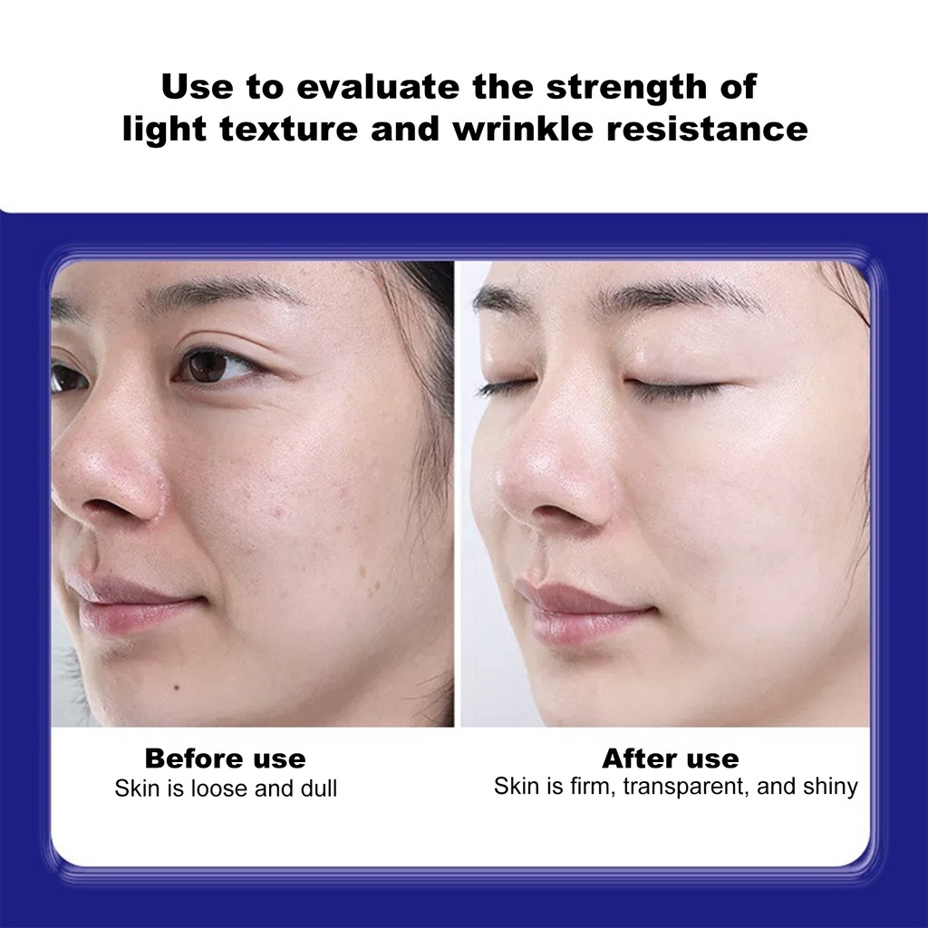 Kem Giảm Nám, Chống Nhăn Và Trẻ Hóa Da UCM Nhật Bản , Săn Chắc Và Chăm Sóc Da Chống Lão Hóa - Kem Nám Nhật | BigBuy360 - bigbuy360.vn