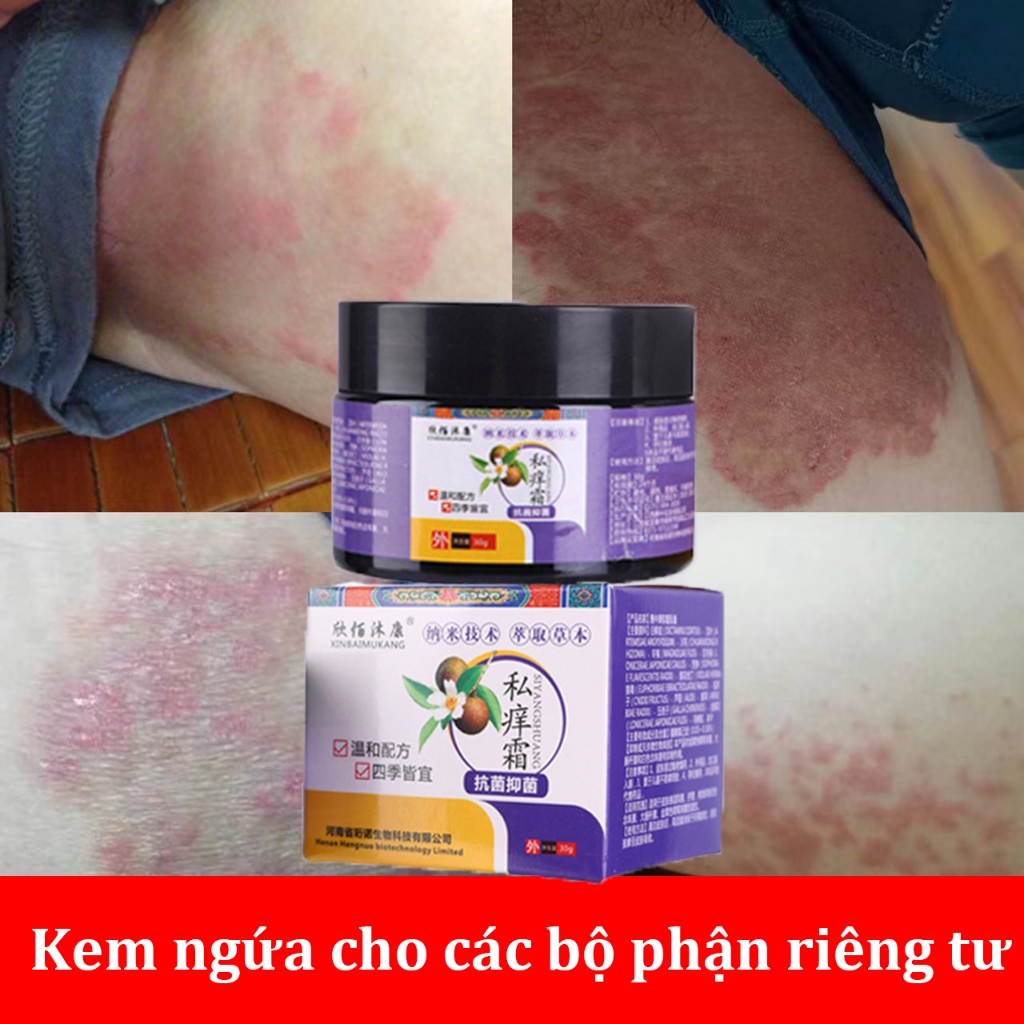 kem bôi da hắc lào 30gkem bôi ngứa kem bôi nấm ngứa nhật bản kem bôi ngứa da bôi hắc lào nấm ngứa ke