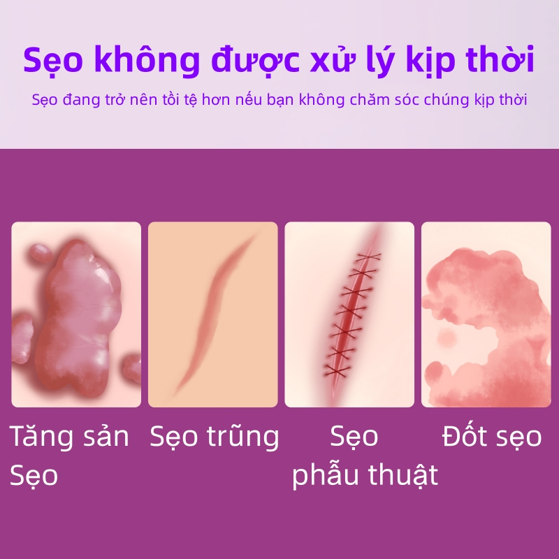 Kem LàM Mờ SẹO ThâM thâm sẹo do bị thương sẹo bỏng