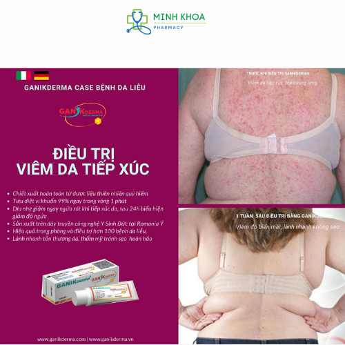 GANIKderma 20ml Kem phục hồi, giúp nhanh lành vết thương sau phẩu thuật, v.i.ê.m da, hăm tả, làm đầy sẹo lõm.