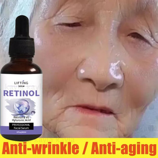 Serum Snail Vitamin E Retinol Facial Serum Whitening Anti Wrinkle Remove Dark Spots Face Essence