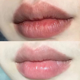 Mặt nạ môi LIPSHIELD- Làm hồng và dưỡng môi