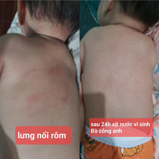 Vi sinh bồ công anh