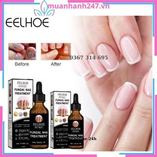 Serum nấm móng tay chân hết sạch nấm, bọng móng, hư khoé, nước ăn tay chân, dưỡng cứng móng