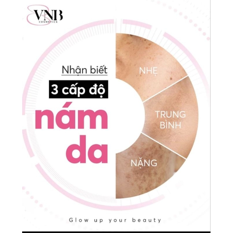 Serum peel 3days vnb ( date 2026)