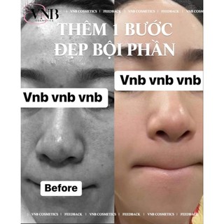 Serum peel 3days vnb ( date 2026)