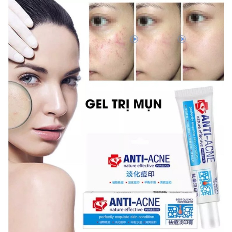 vn 11134207 7r98o lugppok5zj0yfc