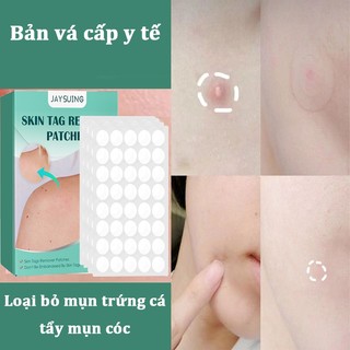 Miếng dán mụn cóc miếng dán mụn miếng dán hút mụn loại bỏ mụn cóc và mụn trứng cá chăm sóc làm sạch da vết chai 120pcs