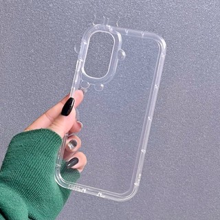 [ SamSung Galaxy A34-5G ] Ốp Lưng Nơ Trong Suốt