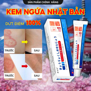 Kem bôi nấm ngứa viêm da cơ địa nhật bản dứt điểm hắc lào, tổ đỉa, vẩy nến, á sừng, lang ben hiệu quả