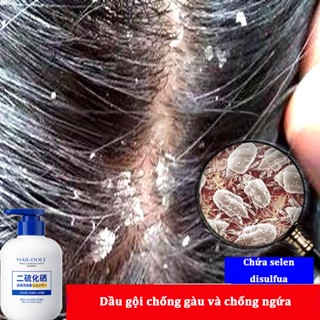  DầU GộI Trị NấM Da đầU DầU GộI Trị GàU DầU GộI Selenium Disulfide KiểM SoáT DầU ChốNg NgứA Và ChốNg GàU 300ml 