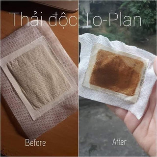 Miếng dán thải độc chân To Plan Nhật Bản 30m