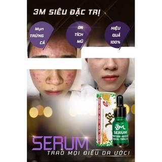 Serum Mụn 3M
