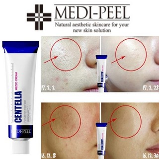 Kem giảm mụn thần thánh Medi-Peel Centella giảm sưng hết thâm mụn trứng cá  30ml Hàn Quốc