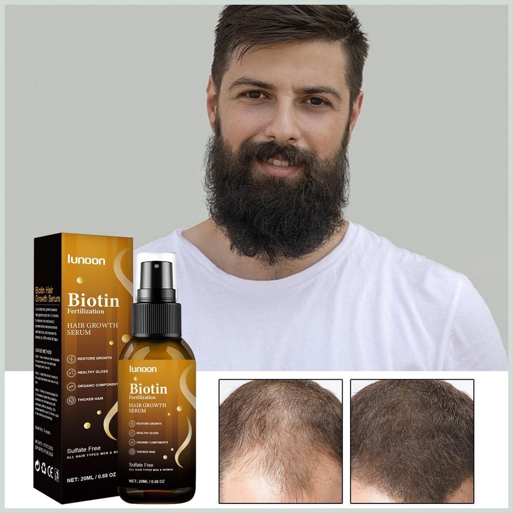 Serum Mọc Tóc Lunoon - Tinh Chất Lunoon Chiết Xuất Biotin Kích Mọc Tóc Nuôi DưỡngTóc Dài Chắc Khỏe Tư Gốc Đến Ngọn