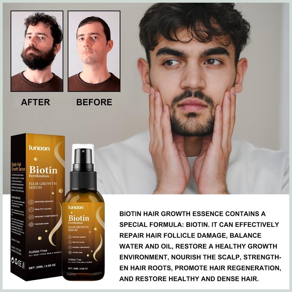 Serum Mọc Tóc Lunoon - Tinh Chất Lunoon Chiết Xuất Biotin Kích Mọc Tóc Nuôi DưỡngTóc Dài Chắc Khỏe Tư Gốc Đến Ngọn