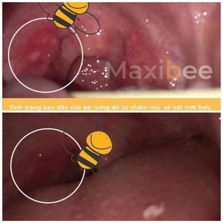 Xịt họng keo ong Maxibee đậm đặc