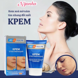 Kem nám tàn nhang Kpem Nga mờ nám tàn nhang đ𝐨̂̀𝐢 𝐦𝐨̂̀𝐢 dưỡng ẩm da phục hồi da -100ML