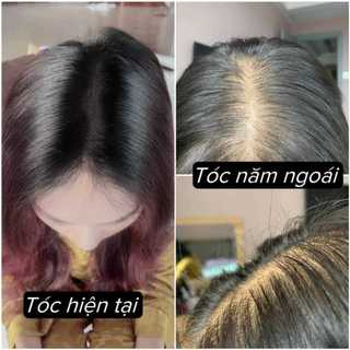 Tinh chất dưỡng tóc Mostal Solution