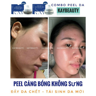 KEM PIU BONG DA CĂNG BÓNG ( tặng phục hồi)