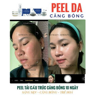 KEM PIU BONG DA CĂNG BÓNG ( tặng phục hồi)