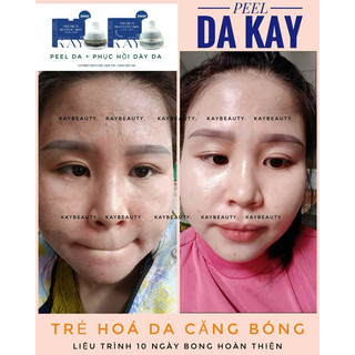 KEM PIU BONG DA CĂNG BÓNG ( tặng phục hồi)