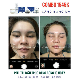 KEM PIU BONG DA CĂNG BÓNG ( tặng phục hồi)