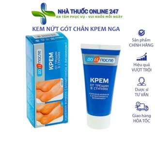 Kem nẻ gót chân Nga Kpem, giảm nẻ chân, nứt chân, khô da chân, dưỡng gót chân
