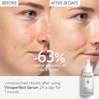 Serum caudalie vinoperfect dưỡng trắng