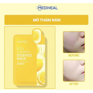[1M]MẶT NẠ DƯỠNG SÁNG DA MỜ THÂM MEDIHEAL VITA
