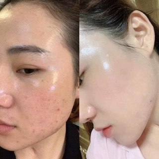 [Loại 1] Kem sâm vàng Thái Lan