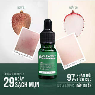 Serum làm lành mụn và thâm Caryophy sạch mụn ẩn mụn đầu đen trứng cá -Bip68