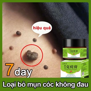 Kem mụn cóc Kem tẩy mụn cóc 20g Loại bỏ mụn cóc thông thường Mụn đá Mụn cơm Mụn cóc dạng sợi