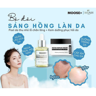 Combo Peel da moose+kem moose phục hồi sáng da 50gam hạn 2027 giúp tái tạo da căng bóng