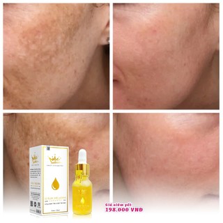 Serum nám melasma pháp cosmetics [chính hãng]