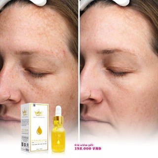Serum nám melasma pháp cosmetics [chính hãng]