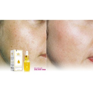 Serum nám melasma pháp cosmetics [chính hãng]