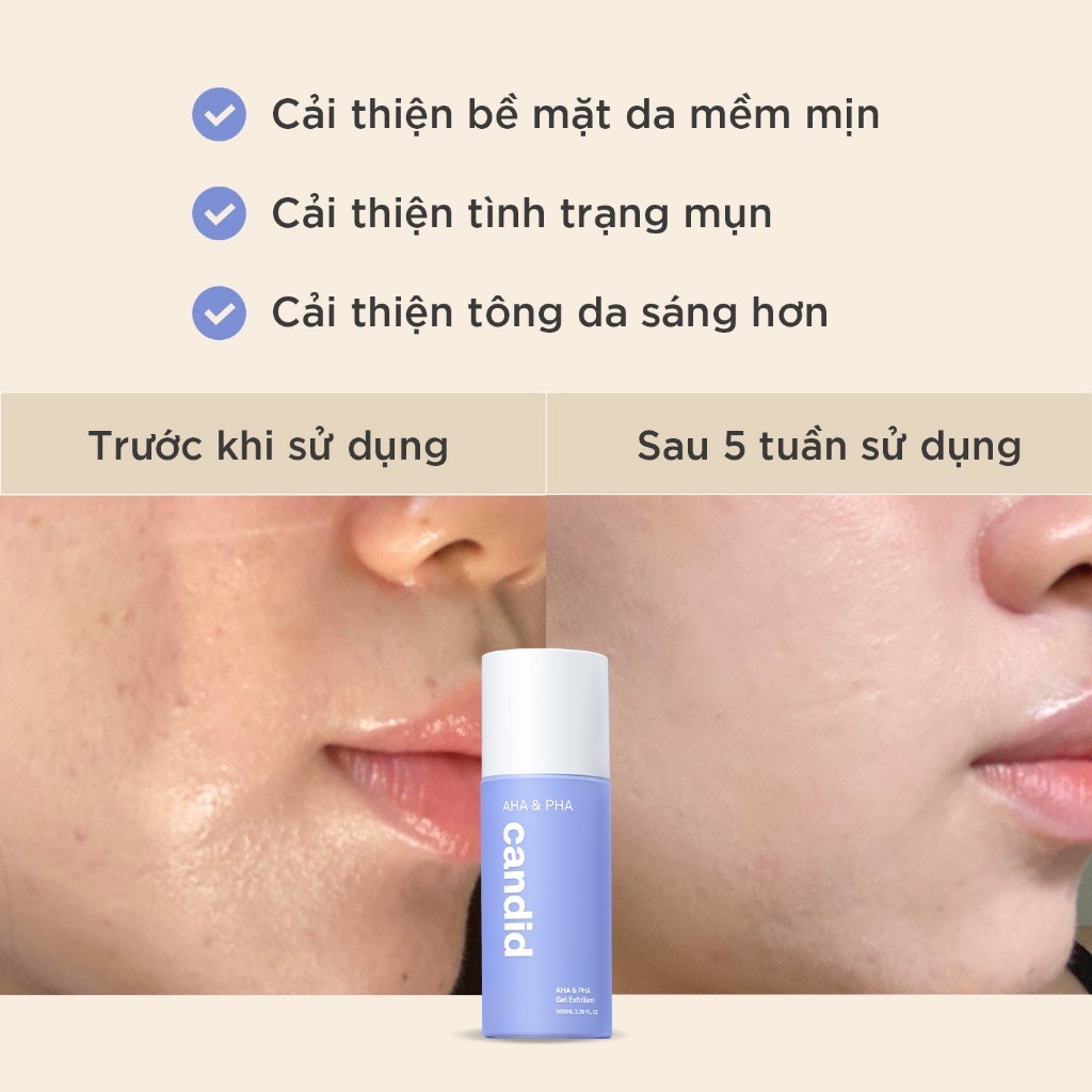 Tinh Chất AHA & PHA Candid Tẩy Tế Bào Chết & Làm Mịn Da Gel Exfoliant 100ml