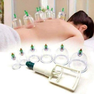 Bộ giác hơi 12 món không dùng lửa