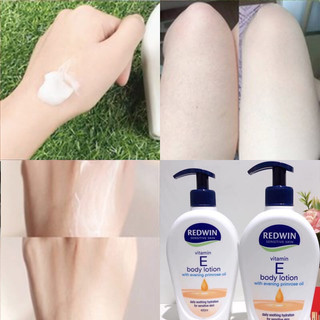 Kem dưỡng Redwin Vitamin E Cream – Úc (400ml)