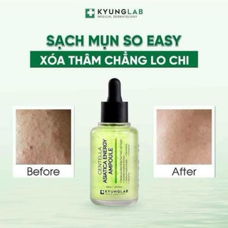 𝐒𝐞𝐫𝐮𝐦 giảm 𝐦𝐮̣𝐧 𝐊𝐲𝐮𝐧𝐠𝐥𝐚𝐛 𝐀𝐂𝐍𝐄𝐒 𝐂𝐞𝐧𝐭𝐞𝐥𝐥𝐚 𝐀𝐬𝐢𝐚𝐭𝐢𝐜𝐚 𝐀𝐦𝐩𝐨𝐮𝐥𝐞 Mẫu mới