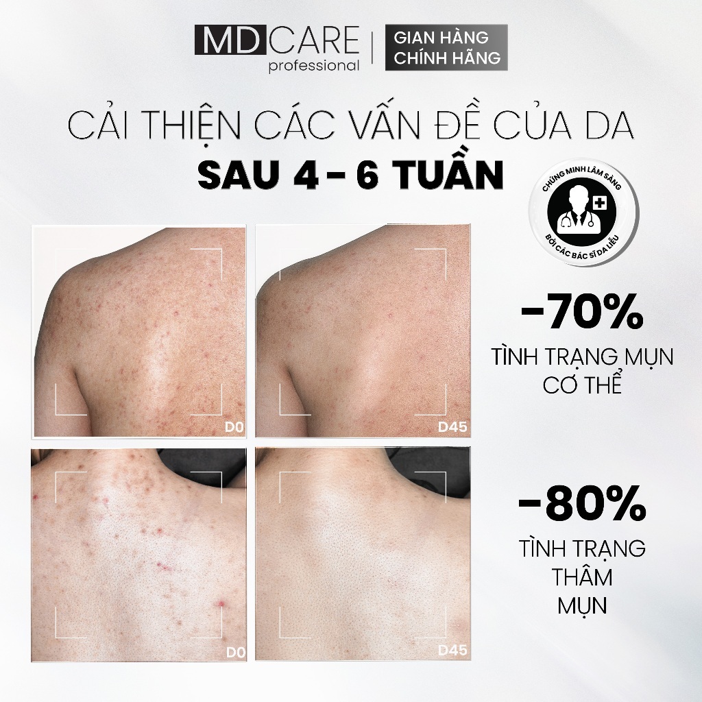 Ảnh 6 của Xịt Tẩy Tế Bào Chết Toàn Thân MD CARE AHAs and BHA giảm tình trạng mụn, thâm trên cơ thể 100ml