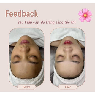 Mặt nạ Kem Ủ trắng da Histrolab  𝙈𝙊𝙄𝙎𝙏𝙐𝙍𝙄𝙕𝙄𝙉𝙂 𝘾𝙍𝙀𝘼𝙈 𝙈𝘼𝙎𝙆