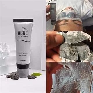 Lột mụn đầu đen/mụn cám Dr.Ance