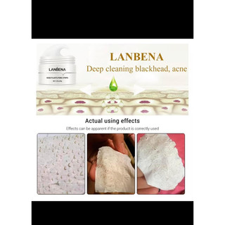 Mặt nạ lột mụn Lanbena