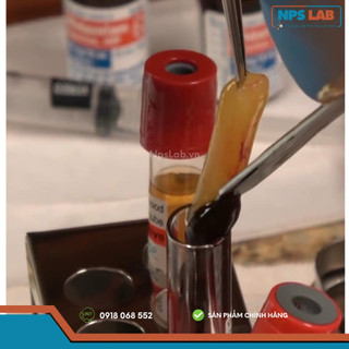 Ống lấy máu dùng để tách PRF (No Additive Tube 10ml)
