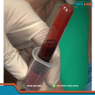 Ống lấy máu dùng để tách PRF (No Additive Tube 10ml)