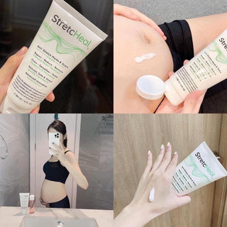 Kem rạn thần thánh Stretcheal 180ml (Hàng nhập khẩu chính hãng Made in USA)