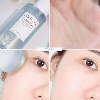 Nước hoa hồng Skin1004 Madagascar Centella Hyalu cica Brightening toner làm sáng và dịu da, giảm sưng viêm 210ml