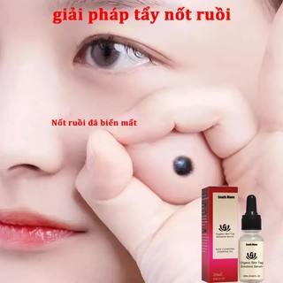 Dung dịch tẩy nốt ruồi tẩy nốt ruồi thuốc tẩy nốt ruồi xoá nốt ruồi tẩy nốt ruồi toàn thân loại bỏ nốt ruồi hiệu quả20ml